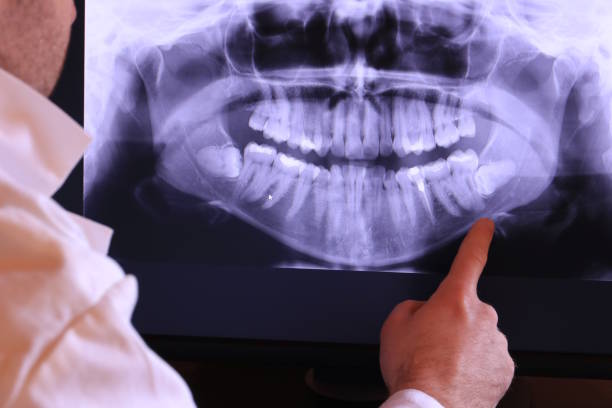 Best Tooth Pain Emergency Relief  in Rockwood, MI