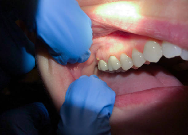 Best Urgent Tooth Repair  in Rockwood, MI