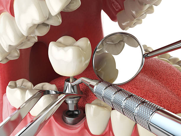 Best Root Canal Emergency Dentist  in Rockwood, MI