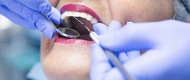 Best Knocked-Out Tooth Emergency  in Rockwood, MI